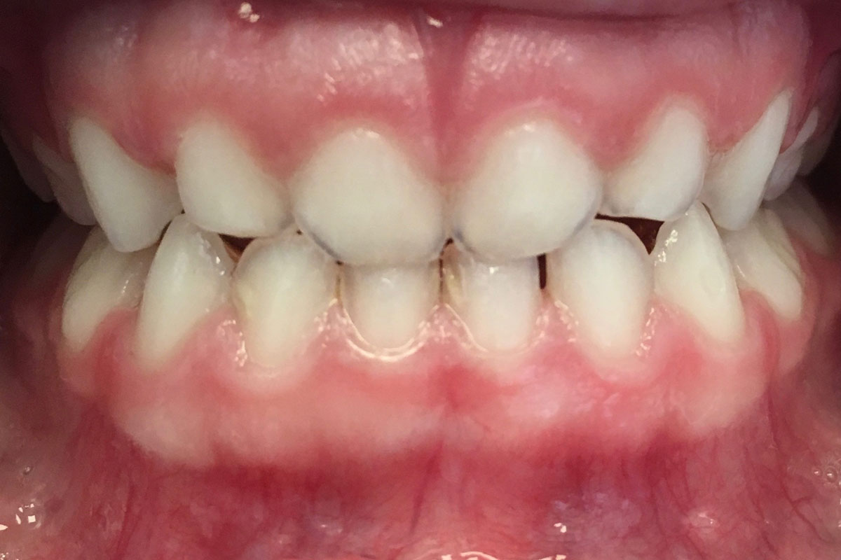 torsello-milani-piacenza-dentisti-dentosofia-dopo