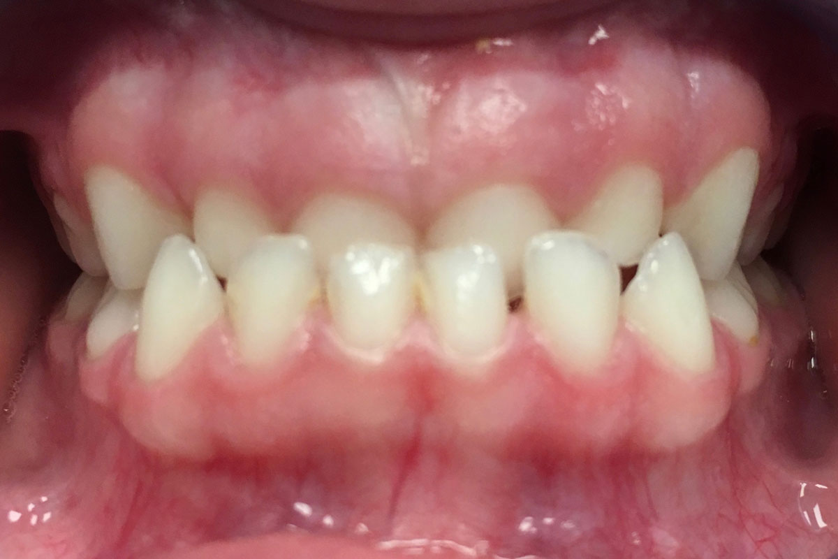 torsello-milani-piacenza-dentisti-dentosofia-prima