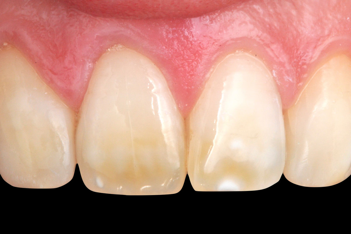 torsello-milani-piacenza-dentisti-estetica-post