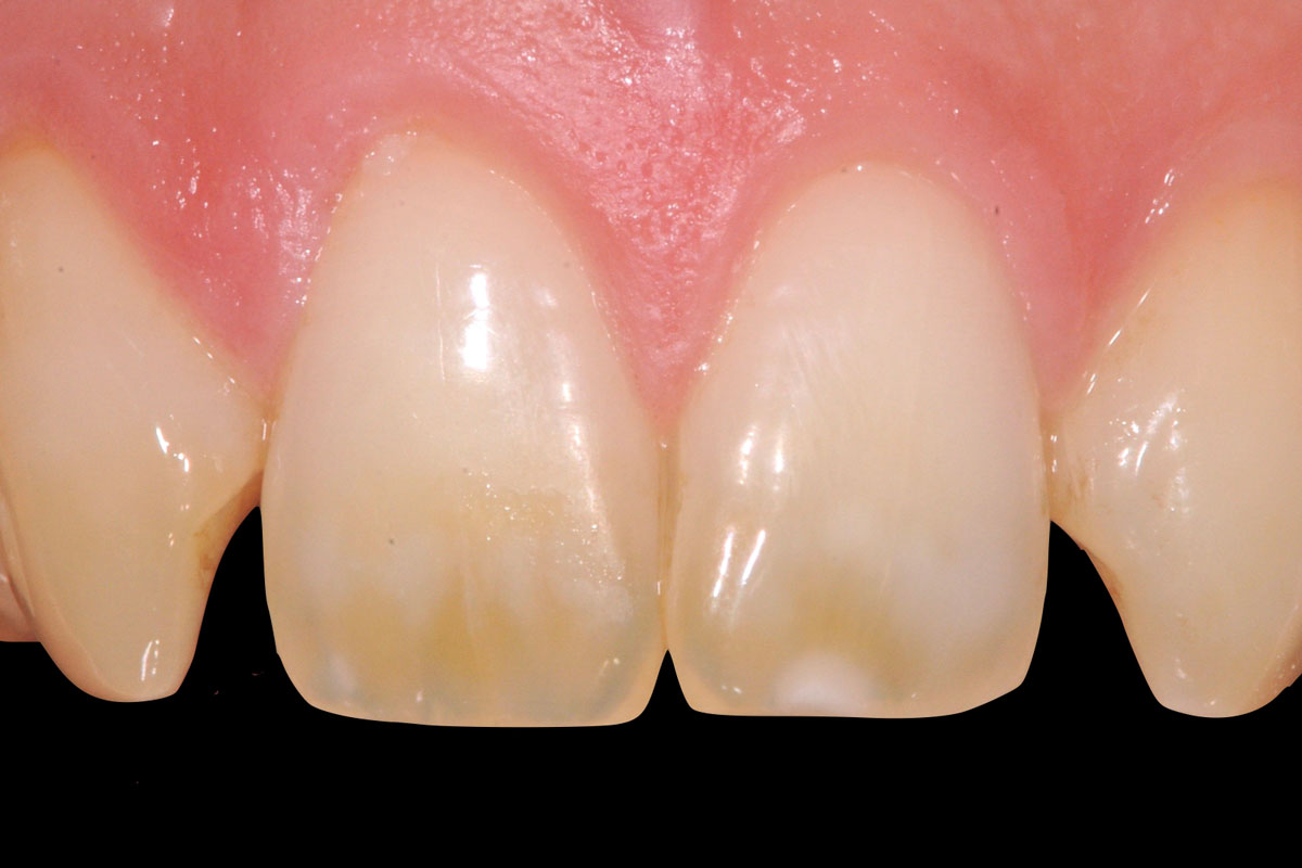 torsello-milani-piacenza-dentisti-estetica-pre